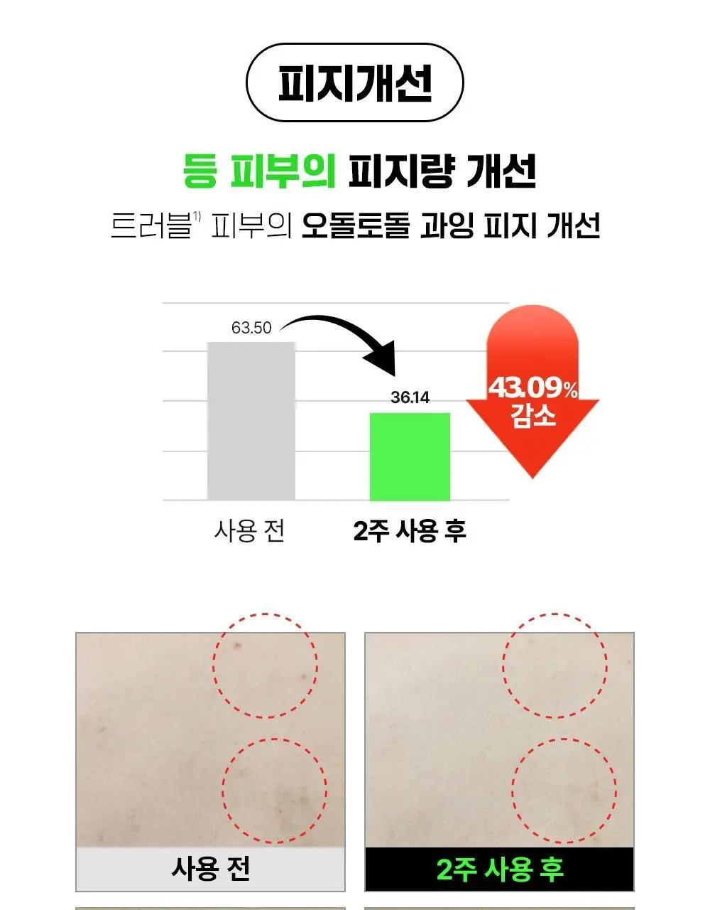 [트러블흔적/단독기획] 파티온 노스카나인 트러블 바디 미스트 145ml 기획(바디워시5ml*4ea) 상세페이지 15